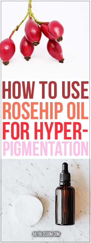 Rosehip oil sounds exquisite doesn’t it? Well, they say it also contains some amazing abilities that can help even out hyperpigmentation on your skin! Scroll down to see how to use rosehip oil for hyperpigmentation. 