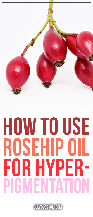 Rosehip oil sounds exquisite doesn’t it? Well, they say it also contains some amazing abilities that can help even out hyperpigmentation on your skin! Scroll down to see how to use rosehip oil for hyperpigmentation. 