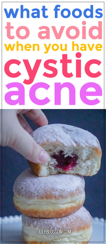 7-foods-to-avoid-with-cystic-acne-july-blossom